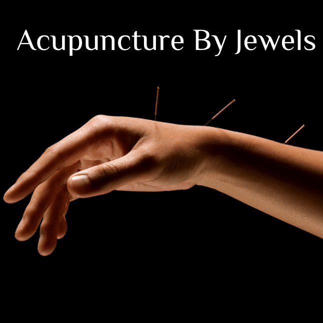 Acupuncture By Jewels