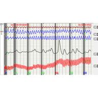 Polygraph and Investigations