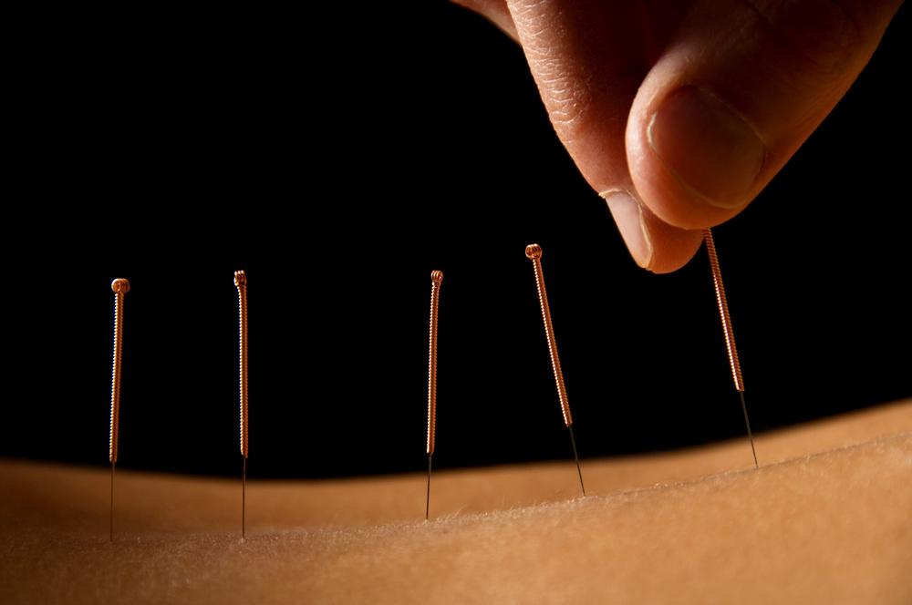 Sacred Lotus Acupuncture & Herbal Clinic