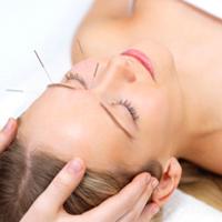 Acupuncture