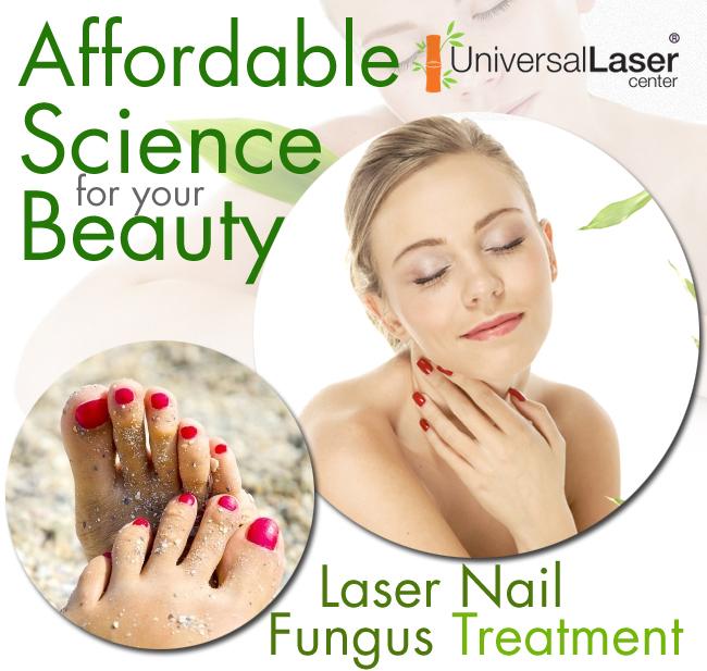 Laser Nail Fungus Treatment