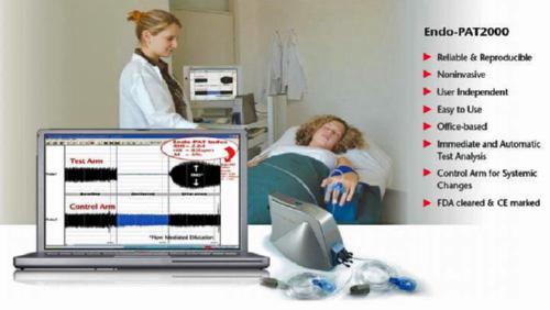 Endothelial Function Testing Easy, Effective and Predictive