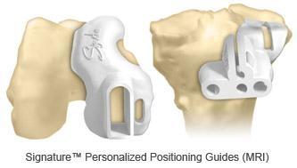 Oxford Signature Partial Knee