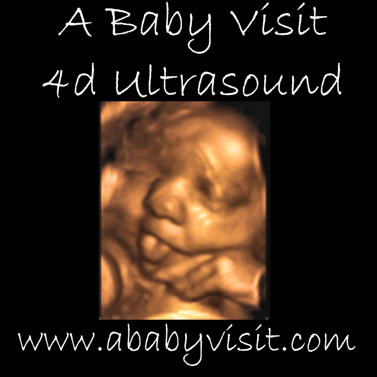 3d ultrasound photo