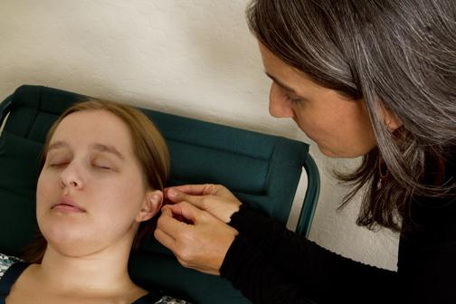 ear acupuncture