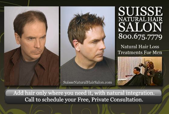 hair loss solutions for men, non-surgical hair replacement.