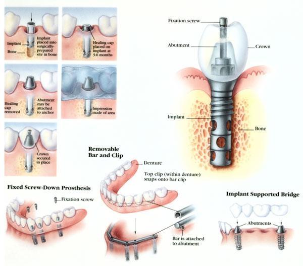 McKinnon Dental