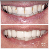 Fort Bend Dental