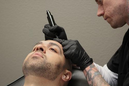 Regrow Micro-Scalp Micropigmentation