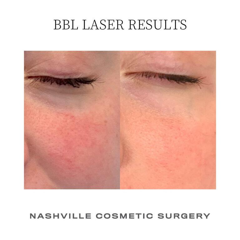 Nashville Cosmetic Surgery