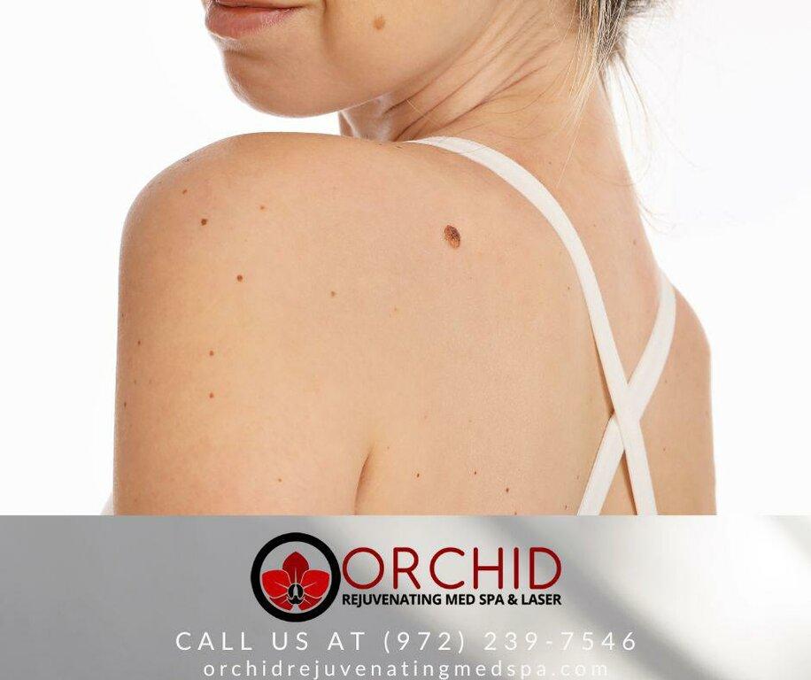 Orchid Rejuvenating Med Spa & Laser