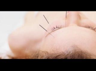 Acupuncture Josee Thibault