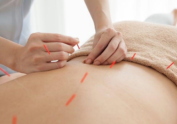 Nanaimo Acupuncture Clinic