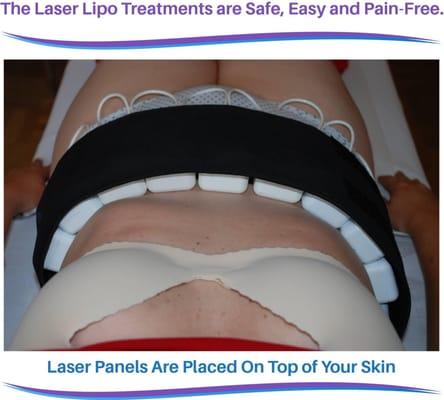 Lipo Laser CNY