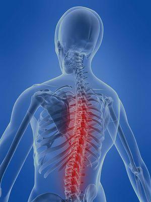 A Subluxation is a chiropractic term that refers to a misalignment of the vertebrae, generally of a minor nature. https://www.salemchirodrx.