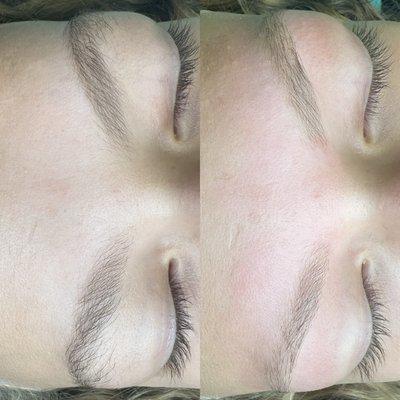 Before & After brow wax