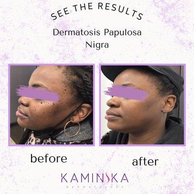 Kaminska Dermatology