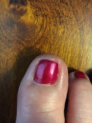 Skin not properly exfoliated or trimmed. Polish a bit sloppy. Top of nail not smooth or straight across.