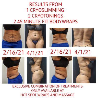 $149 intro 60 minute FIT Bodywrap (REGULARLY $199)
 $250 Intro Cryoskin service (REGULARLY $599)
 Space is limited!