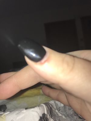 Cut on my thumb cuticle, red and scabbed