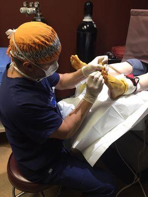 Dr. Moran performing a flexor tenotomy.