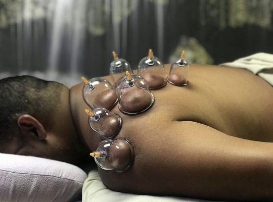 Dry cupping