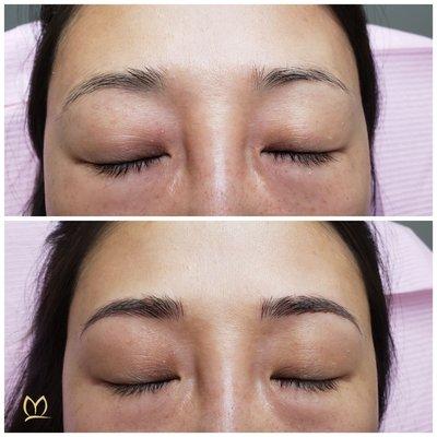 Microblading only