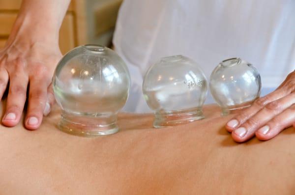 Cupping Massage