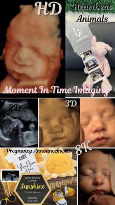 Pregnancy Announcements, 3D/4D Ultrasounds, Heartbeat Animals