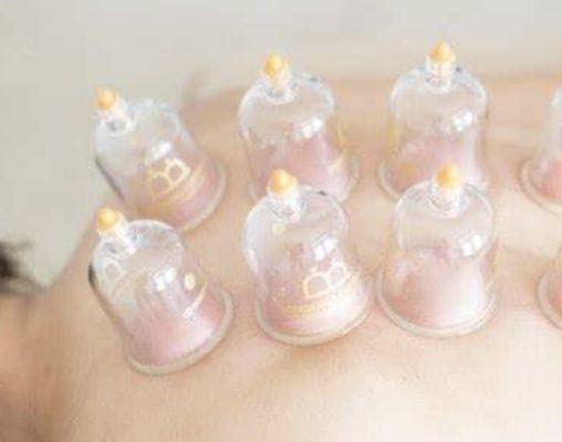 Cupping Therapy