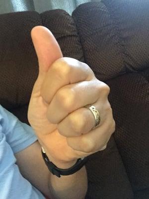 Thumbs up