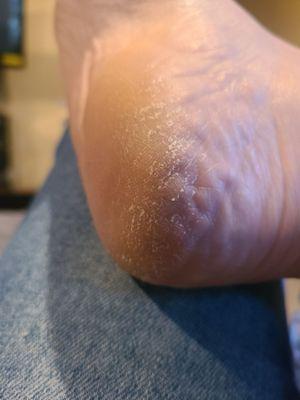 Dry heels that weren't hardly scrubbed. (I get frequent pedi's, it shouldn't look like this)