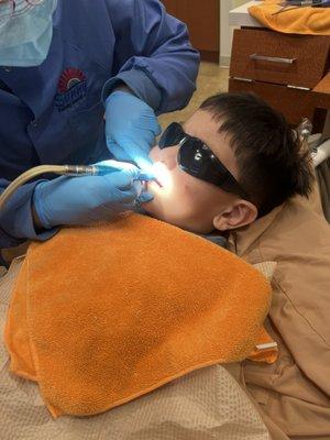 Leo my autistic child (5) getting his teeth cleaned