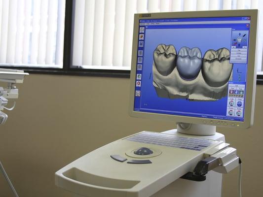 Our CEREC machine, takes digital impressions to make porcelain crowns in about an hour.