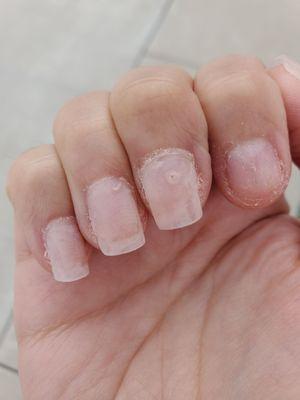 Nails not cured or placed right. This is why I chose not to continue the nails.