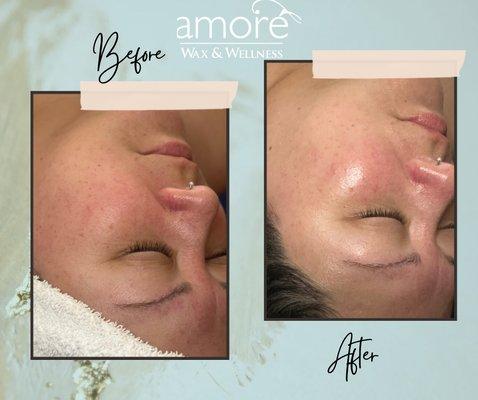 Amorè Signature Facial