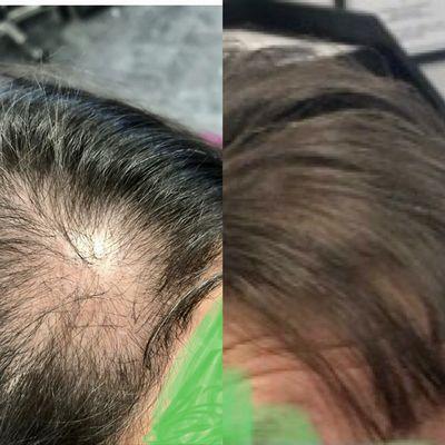 Before and after 9 months of treatment.