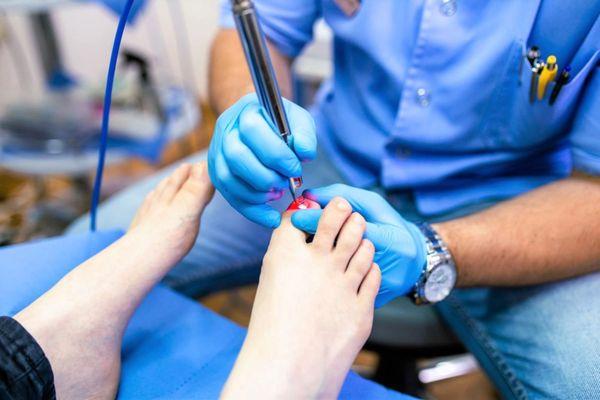 S.F. Bay Area Podiatry Group - Nail Laser Center