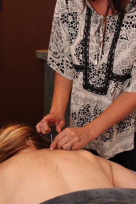 Traditional acupuncture treatment.