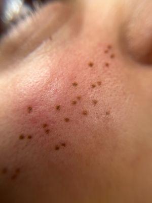 Close up of freckle tattoos