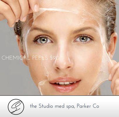 Chemical Peels