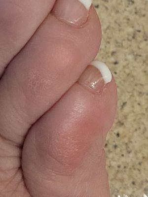 Just left my pedicure with a boo boo on my little toe and dry skin on my feet.  No lotion or nothing!  That's a $130.00 pedicure