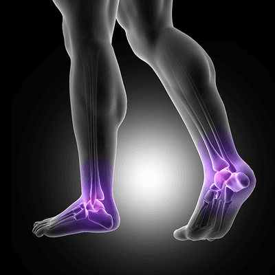 Think arthritis in your feet only affects older adults? Conditions like rheumatoid arthritis can impact anyone...