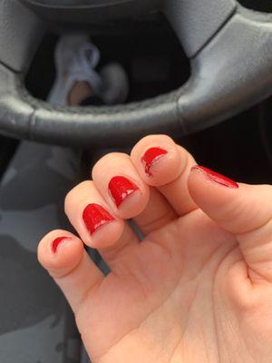 Bad nails