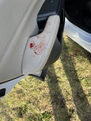 A different door handle full of blood