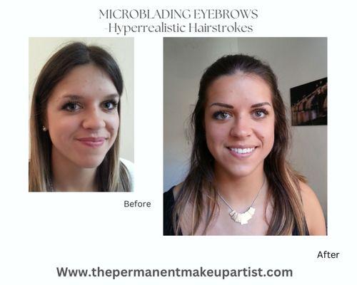 Microblading  involves semi-permanent eyebrow tattooing to enhance the shape and fullness of natural brows.