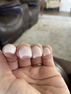 Middle fingernail is 2-3x thicker.