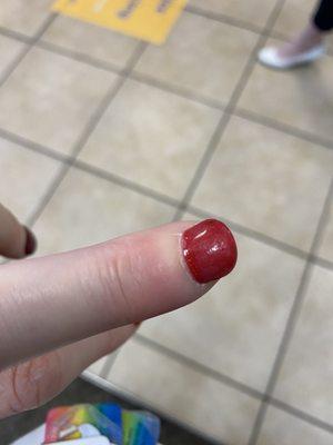 My finger that is infected after getting a manicure at this salon.