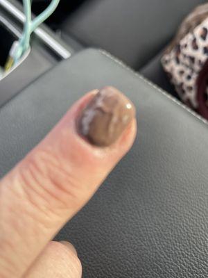 This is one of the "fixed" nails.