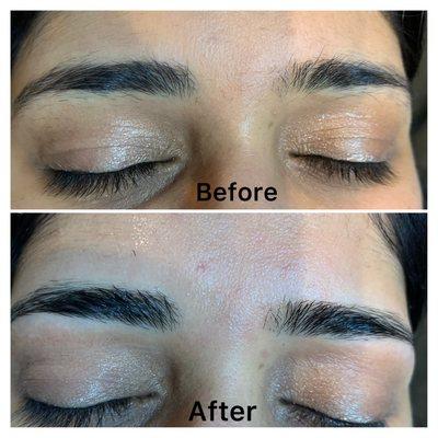 Before And After pictures of eyebrows